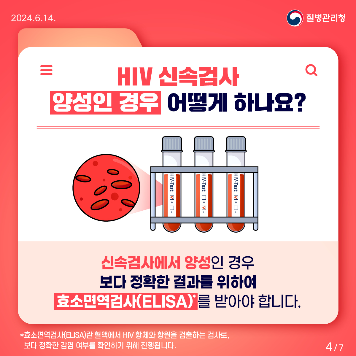 HIV 감염의 신속한 확인은 신속검사로!4